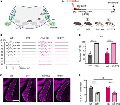 Peripheral Fragile X messenger ribonucleoprotein is required for the timely closure of a critical period for neuronal susceptibility in the ventral cochlear nucleus